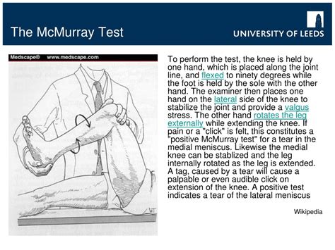 positive mcmurray test meaning